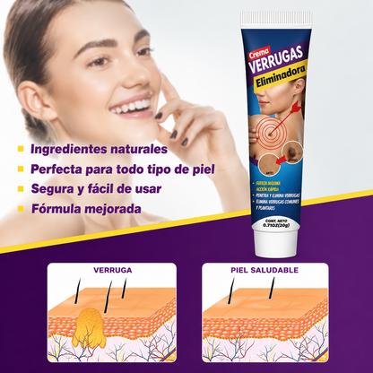 WART REMOVER│Elimina Verrugas