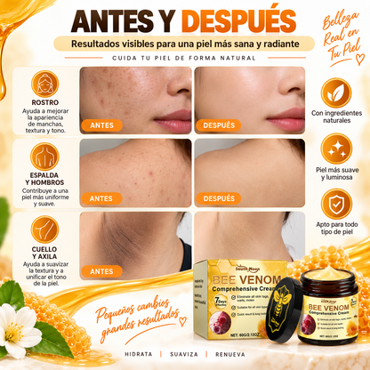 BEE RENEW™ | Crema Reafirmante con Veneno de Abeja